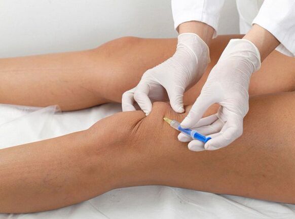 Diz artrozu için eklem içi enjeksiyon